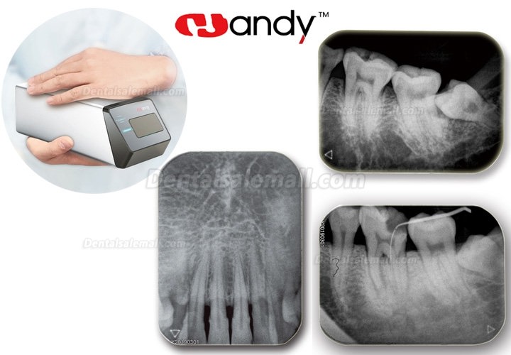 Handy HDS-500 PSP Scanner Digital Dental Imaging Phosphor Plate Scanner